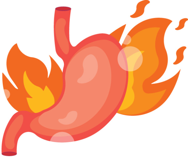 6 вопросов об изжоге